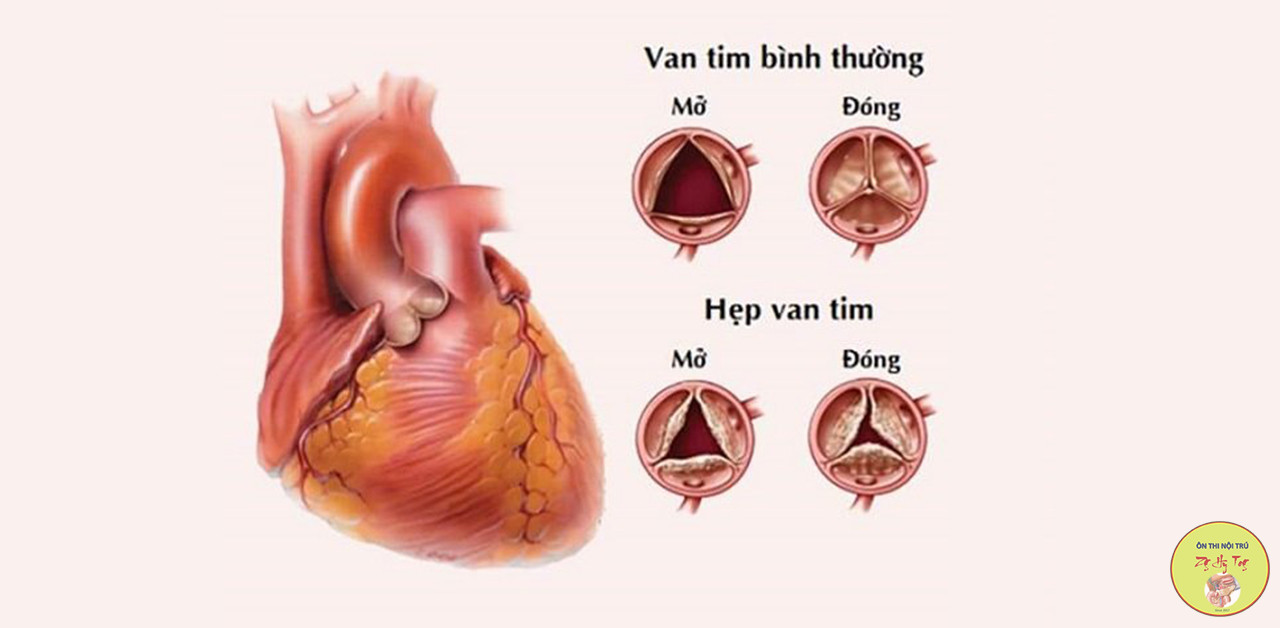 HẸP