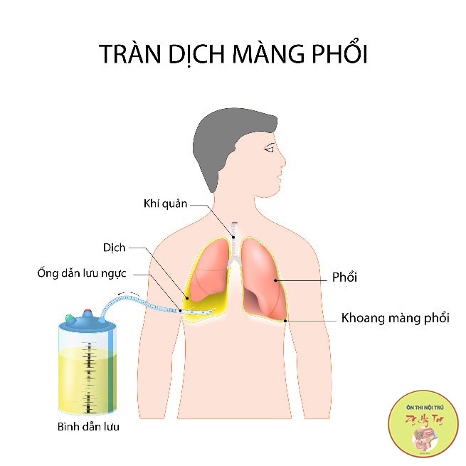TRÀN