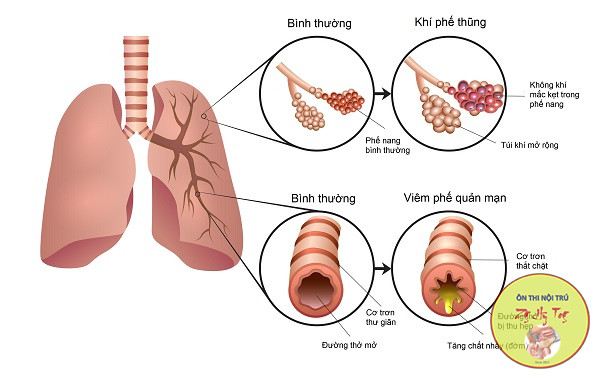 BỆNH