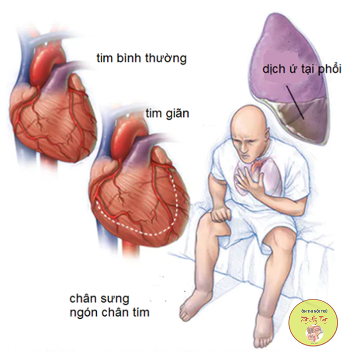 NỘI
