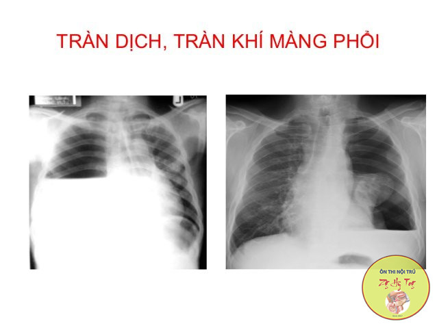 TRÀN